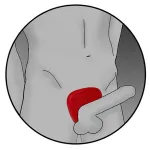ELECTRASTIM - PROTÈGE-BITE VIPER SILICONE FUSION